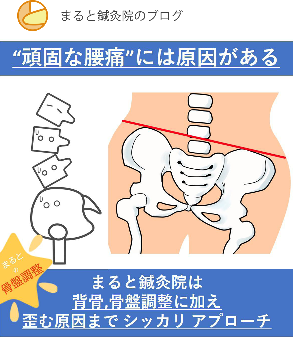 まると鍼灸院の腰痛施術(腰痛には原因がある)